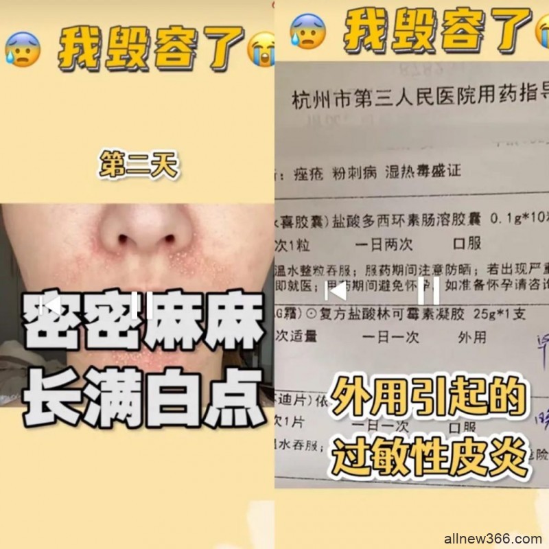 家暴电竞男示爱主持人？小霸宠疑似遇pua？前男友爆煎饺生图？小蛮过敏毁容？党妹卖写真翻车？