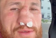 梅拉布·德瓦利什维利鼻骨两处骨折仍要打!放话硬刚亨利·塞胡多,大发体育助力你的致富之路!-蜗牛扑克官方-GG扑克